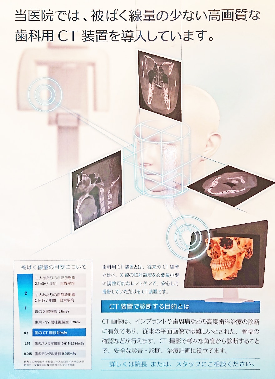 歯科用CT